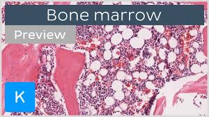 Red marrow in adults, red marrow is confined mostly to skeletal system bones of the skull, pelvis, spine, ribs, sternum, shoulder blades, and near the point of attachment of the long bones of the arms and legs. Bone Marrow Location And Labeled Histology Preview Kenhub Youtube