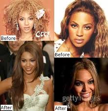 Pin By Sea Adams On Queen Bey 3 Plastic Surgery Bad Celebrity Plastic Surgery Celebrity Plastic Surgery