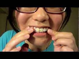 How To Make Fake Braces Fake Braces Diy Braces Halloween Coustumes
