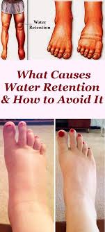 Pin On Healthy Tips