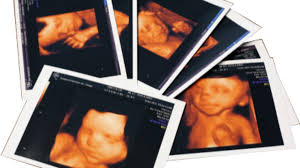 At pregnancy week 6 it is quite possible you are just discovering that you are pregnant. How Early Can You See A Baby On An Ultrasound Scan Peek A Baby