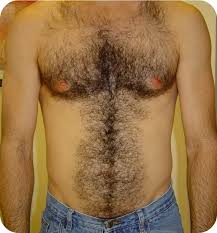 Come see the favorite laser hair removal destination for 2010. Laser Hair Removal Munster In Chicago Il Bare Tattoo Hair Removal