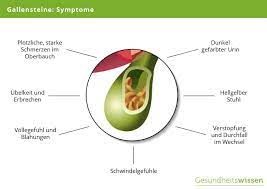 Gallensteine Ursachen Symptome Diagnose Behandlung