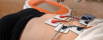 Image result for Electrical Stimulation Therapy