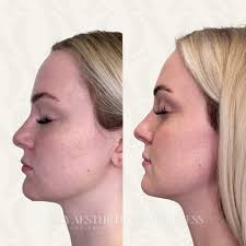 Luxury Anti-aging & Longevity Clinic in Rogers, AR