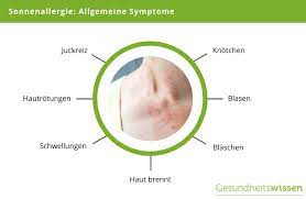 Sonnenallergie Ursachen Symptome Behandlung