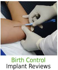 Birth Control And Pull Out Method Reddit Birth Control Arm Implant Birth Control Implant Birth Control Arm Implant