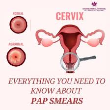Image result for Pap Smear