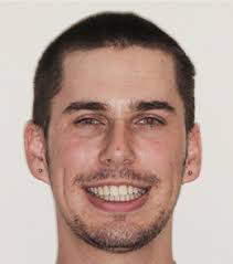 Book Your Orthodontic Consultation