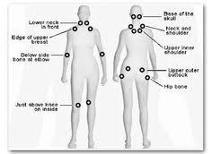 10 elegant fibromyalgia tender points chart images