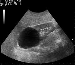 Pin On Abd 200 Mod 3 Ultrasound
