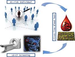 If symptoms do occur in the early stages of lung cancer, they can include: Overview Of Lung Cancer Early Detection Mass Population Screening Download Scientific Diagram