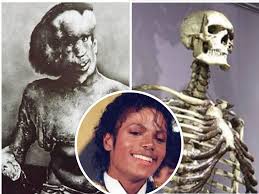 FUTURE SHOCK: Eternal humiliation of Elephant Man and Irish Giant should shame us all - not just Michael Jackson and Scottish surgeon | The Herald