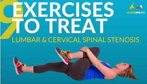 9 Exercises For Lumbar And Cervical Spinal Stenosis Cervical Spinal Stenosis Spinal Stenosis Stenosis Exercises
