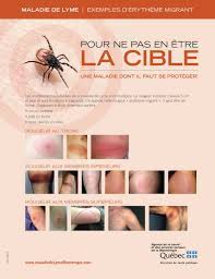 • les préparations magistrales que nous utilisons sont basées sur l'ancienne formule du tic tox. Dossier Sur La Maladie De Lyme Y Voir Plus Clair Part 3 Traitement Atlane