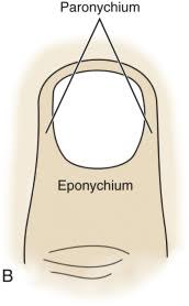 Image result for paronychium