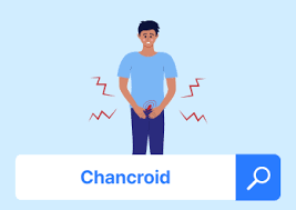 Image result for chancroid