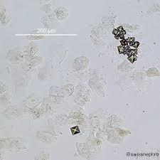 Pin On Nephro Pics