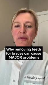 Removing teeth for braces can cause MAJOR problems. Here's why. #braces  #removingteeth #holistichealth #biologicaldentist #dentalprocedure  #oralsurgeon #teeth #tooth