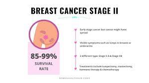 Neoadjuvant chemotherapy, endocrine therapy, and targeted therapy for breast cancer. Everything About 5 Stages Of Breast Cancer With Treatments