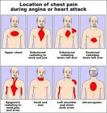 Know Your Nitro It Could Save Your Life Cardiac Nursing Nursing Care Nursing Care Plan