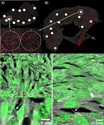 Treatment with tumor-treating fields (TTFields) suppresses intercellular  tunneling nanotube formation in vitro and upregulates immuno-oncologic  biomarkers in vivo in malignant mesothelioma