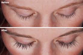 Well, now push your awkwardness aside and get ready to look beautiful with longer as well as thicker lashes. Latisse For Longer Eyelashes Safe For Your Eyes