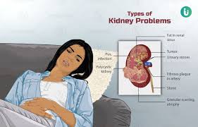 End stage renal disease new patient education manual. Kidney Diseases Symptoms Causes Treatment Medicine Prevention Diagnosis