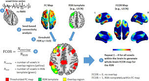 This game has engaging puzzles that keep you playing and loving it continuously. Identifying The Brain S Connector Hubs At The Voxel Level Using Functional Connectivity Overlap Ratio Sciencedirect