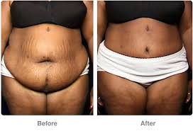 Pin On Cosmetic Plastic Surgery