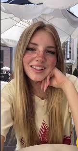 Now i wish i had freckles 💛💛💛 #fyp #annakatedooley