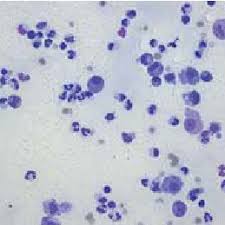 The prevalence of al over ibd has been. Pdf Cytology Of Abdominal Masses In Cats