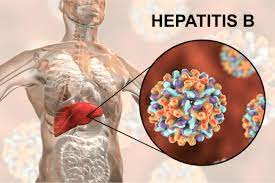 The centers for disease control and prevention is a good place to start. Hepatitis B Ansteckung Symptome Behandlung Schutz Herbstlust De