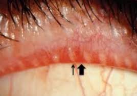 Image result for Blepharis gazensis