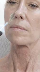 Ryan Talmadge (105ifo3wkwtm3wlokvm24bn2t236ou)