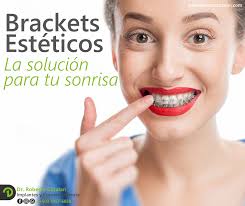 Implantes y Cosmética Dental, Dr. Roberto Catalan