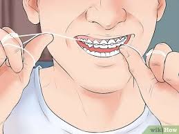 Learn how to have better relationships and care for youself with wikihow.life. 3 Ways To Take Care Of Your Braces Wikihow