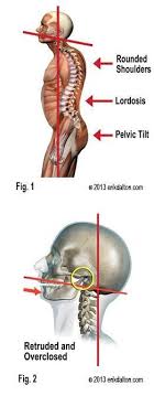 Pin On Stretching Massage