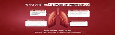 Image result for Pneumonia