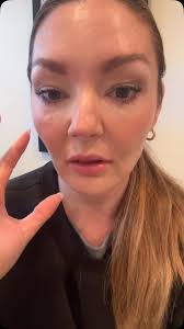 #mua #makeup #darkcircles #colorcorrection