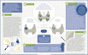 Image result for Hyperparathyroidism