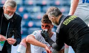 Шик патрик / patrik schick. Shik Iz Chehii Zabil Penalti S Razbitym Nosom No Tak Nelzya On Dolzhen Byl Ujti S Polya I Poluchit Pomosh Gol Ru