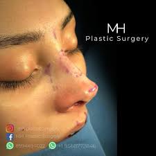 MH Plastic Surgery