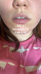 Ashley Piercing Geschwollen