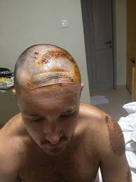 Update: day 2 & now have a sponsor. Much love everyone ❤️ Hi everyone, My  name is Shane Fixter, I'm 39 years old, and I live