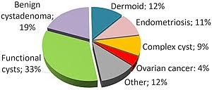 Ovarian cancer may not cause any signs or symptoms in its early stages. Ovarian Cyst Wikipedia
