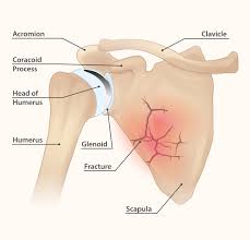 Stiffness in the area of the shoulder blades usually reveals you are going in the wrong direction in. Pain In And Under The Shoulder Blade Your Guide To Pain Relief