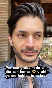 Daniel Elbittar muestra cómo quedó su rostro tras intoxicarse