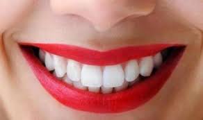 New zealand kelinci dutch jantan yang memiliki gigi insisivus kanan dan kiri atas yang mengalamai maloklusi. Cantik Dental 55 Bandung