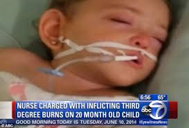 Toddler Suffered Third Degree Burns After Nurse Put Her In Scalding Bath Then Dressed Her In Clothes That Had To Be Cut Off Daily Mail Online